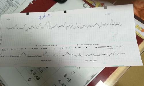 如何解决洗衣机胎动过大问题（快速解决洗衣机运转时发生的强烈晃动）  第1张